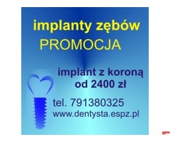 Implanty dentystyczne od 1100zł